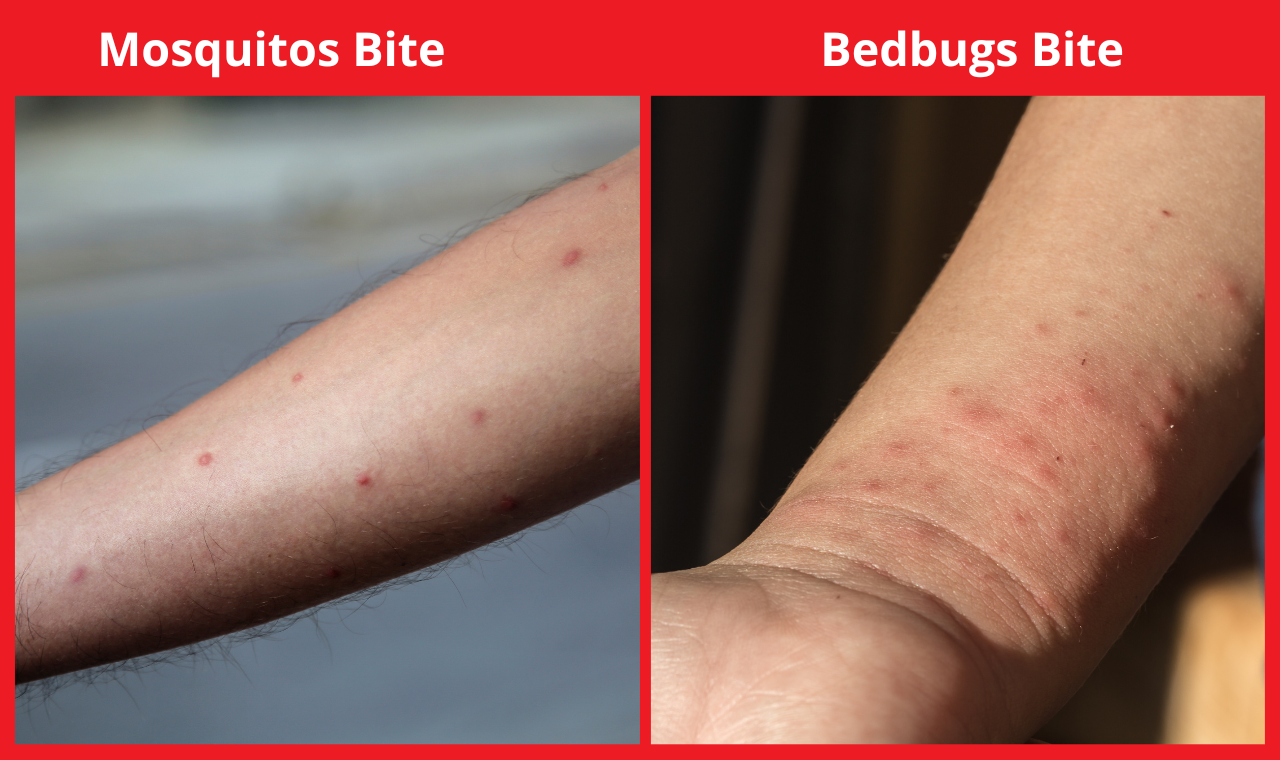know-about-mosquitoes-and-dengue-in-singapore
